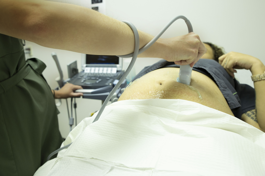 image of a pregnant patient getting an ultrasound